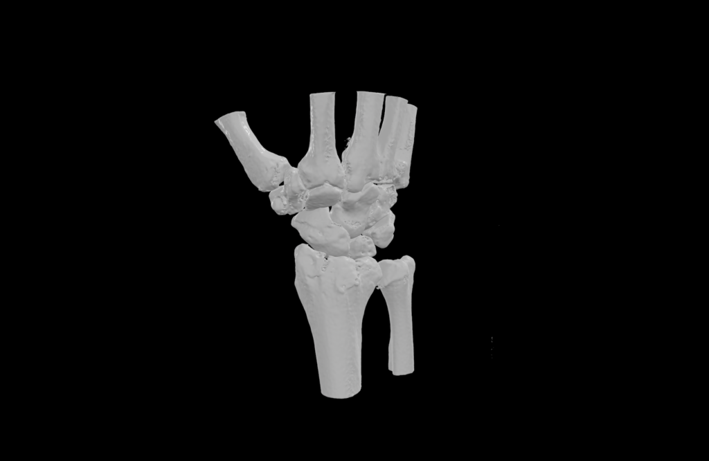 Human wrist cleaned sty