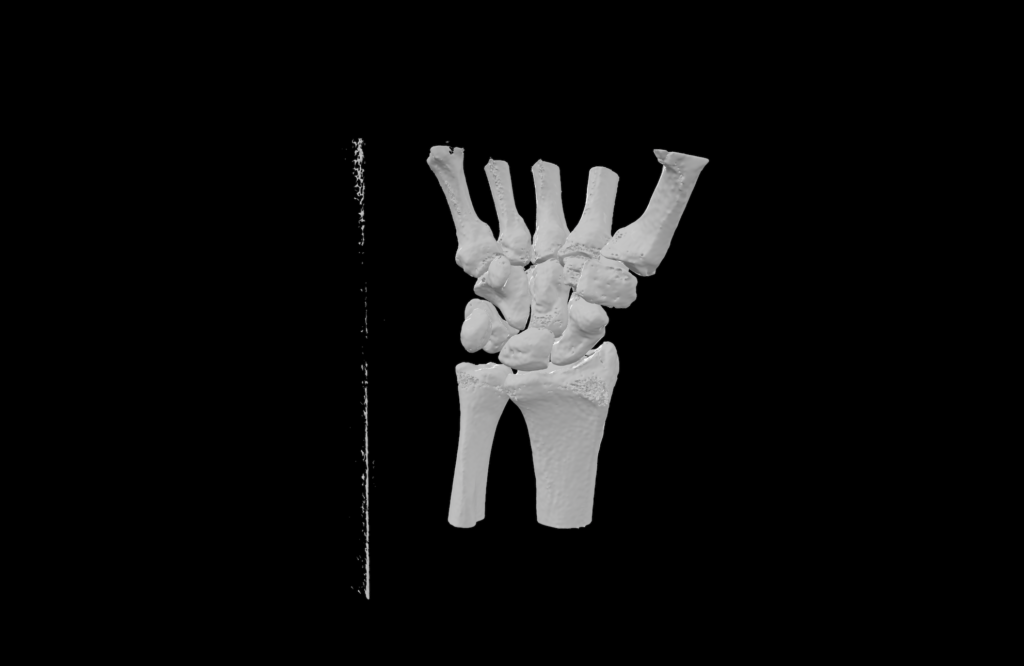 Human wrist cleaned 3d printable stl